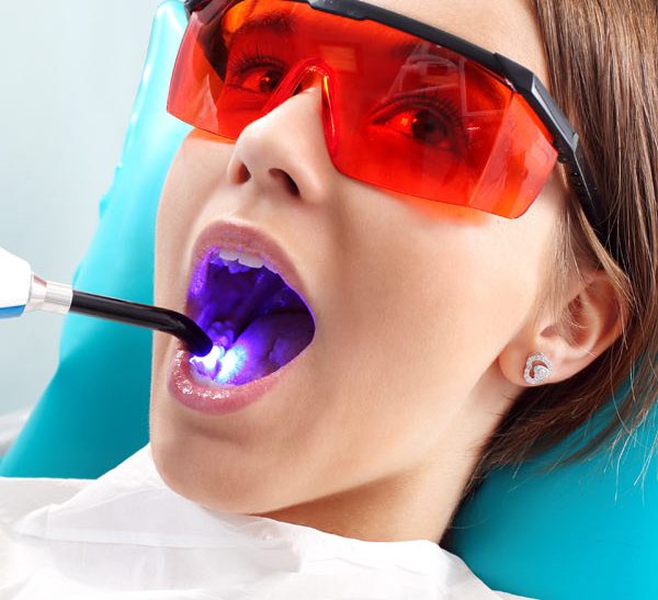 Soft Tissue Laser Surgery Great Lakes Dentist